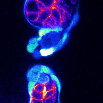 Zebrafish heart valve