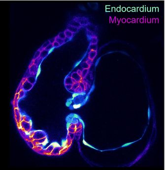 Zebrafish heart