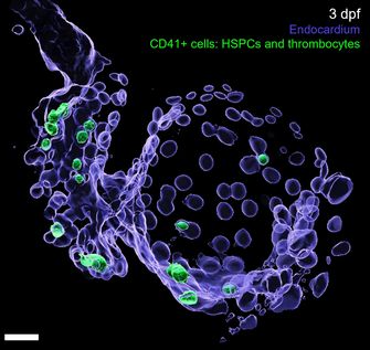 HSPC endocardium