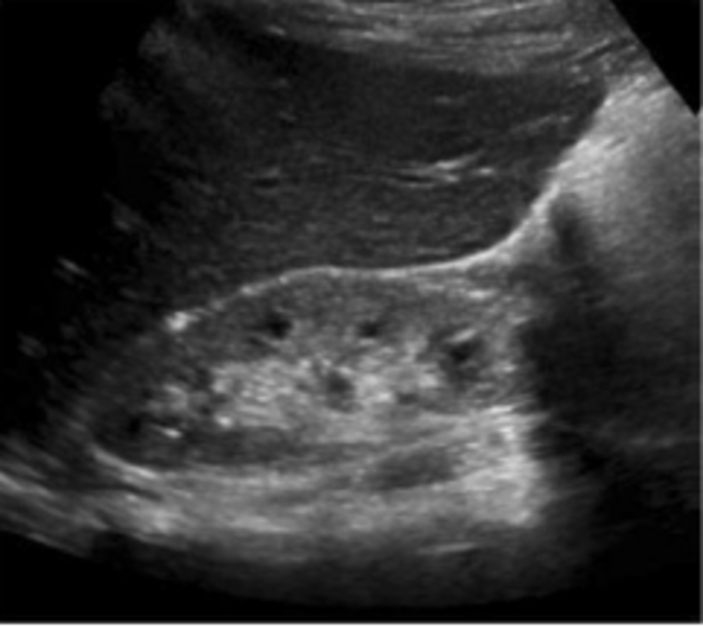 Sonographie